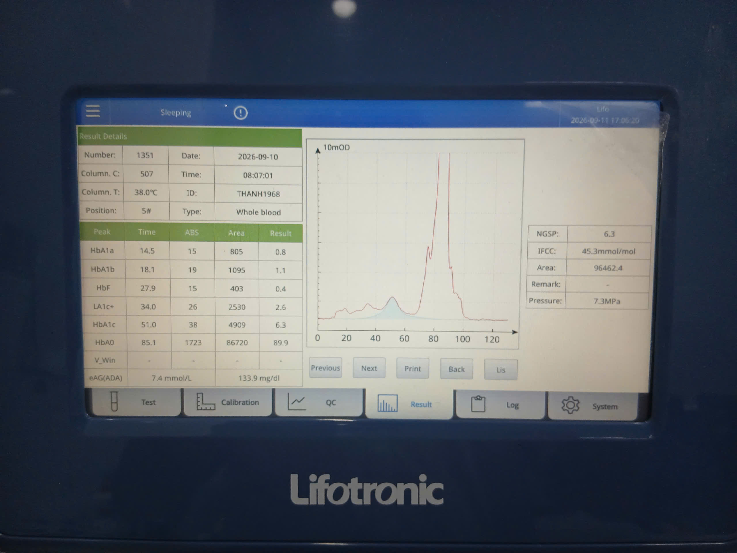 Máy HbA1C tự động (sắc ký lỏng)